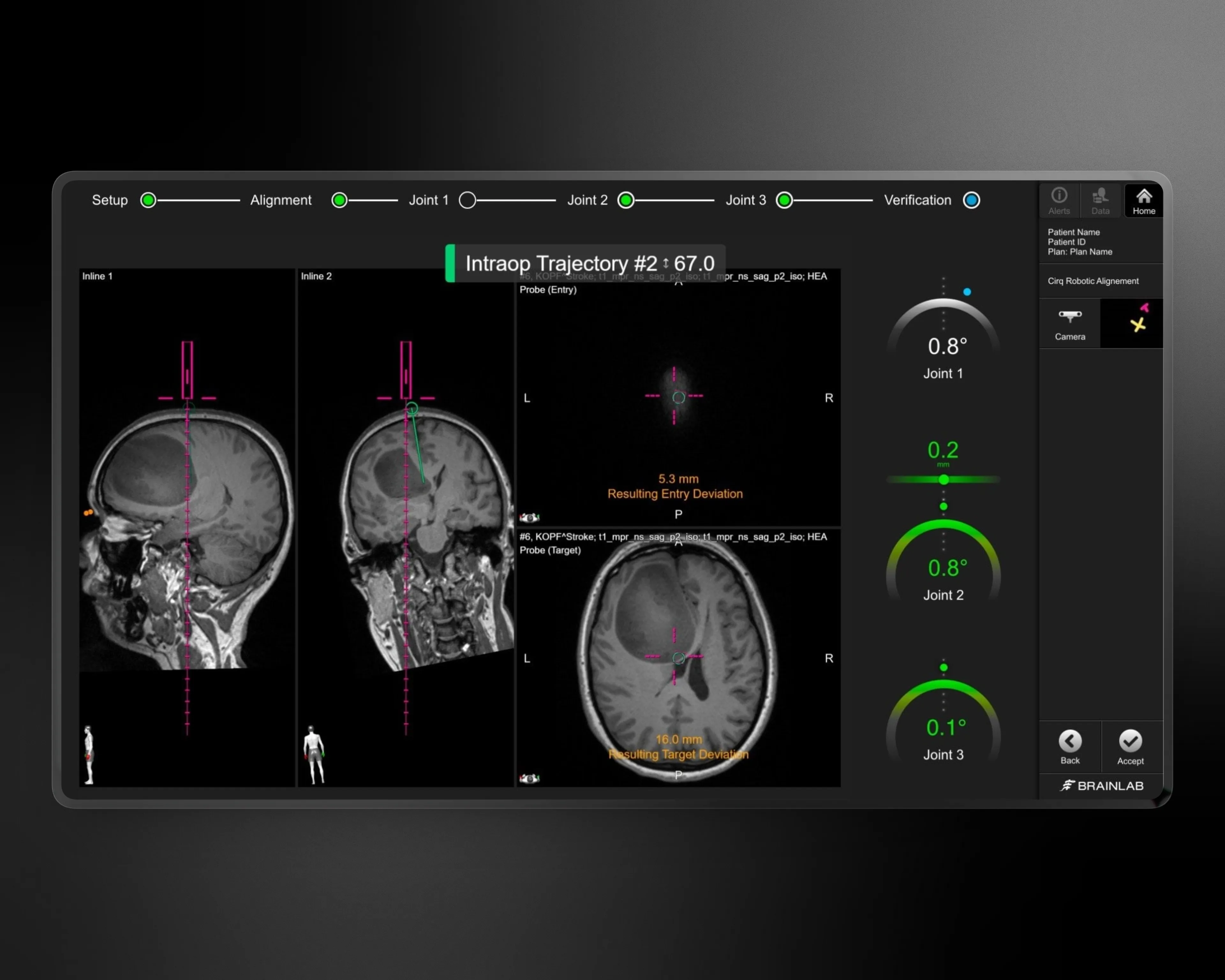 Verification screen with MRI views and all joint readings shown simultaneously for expert confirmation